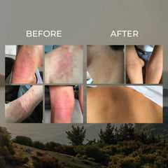 Miracle Manuka - Skin Repair Ointment BODY Sven's Island 